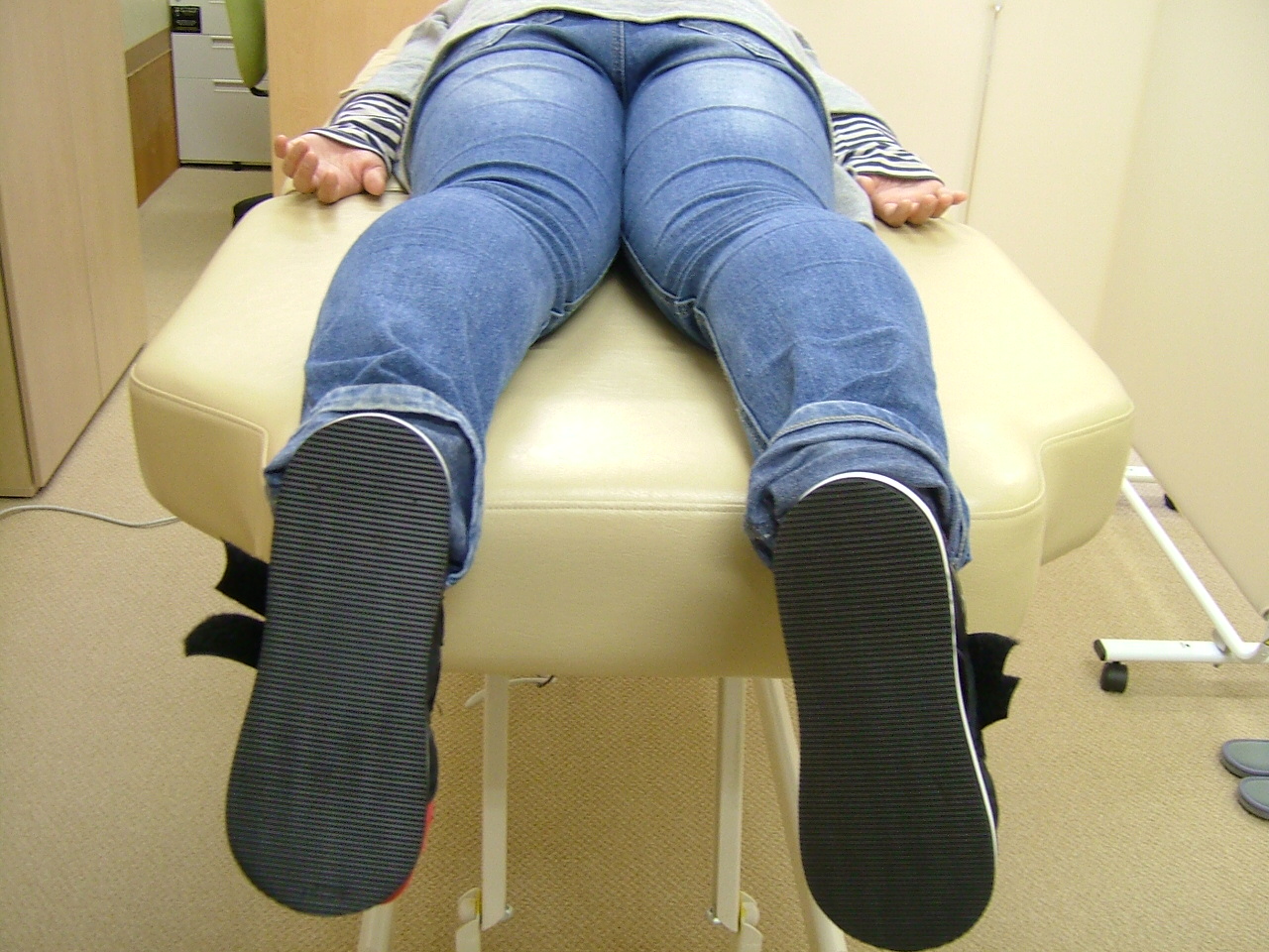 31女性施術前の写真